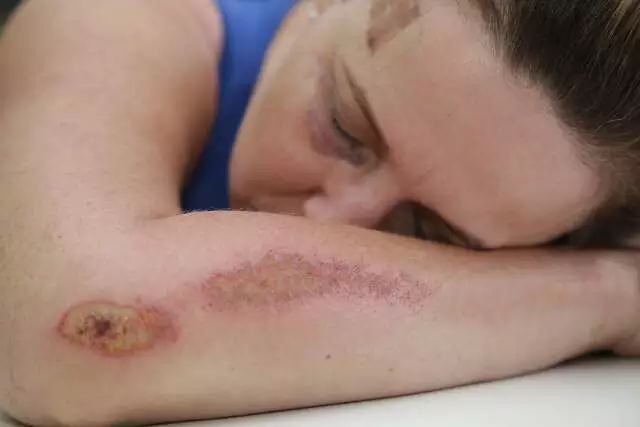 478 mulheres sofreram violência doméstica nos primeiros 10 dias de 2026